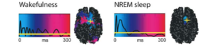 Current maps of the brain during wakefulness and NREM sleep after magnetic stimulation across the skull. The colour coded areas indicate the extend of spread of the current in the brain. While in NREM sleep the map is localised, in wakefulness the current spreads across both hemisphere.