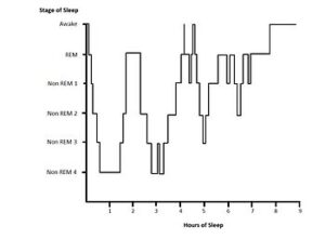 Hynogram is the summary of the stages of sleep that patient goes through in an overnight polysomnographic recording. NREM and REM occurs in a cycle of 45-60 minutes. In the initial part of the sleep, the NREM sleep predominates. The duration and the depth of NREM would be more in the initial few hours. As the sleep debt abates, the NREM duration and depth reduces and REM duration and frequency increases. The increased frequency of vivid dreams are related to the occurrence of frequent REM sleep in the later part of sleep.